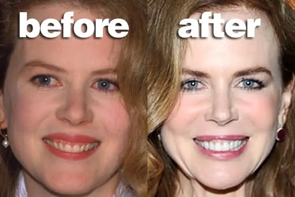 before-after_misleading
